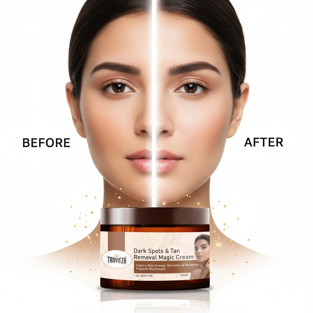 Trovieza Magic Cream for Spot & Tan Removal – 50gm